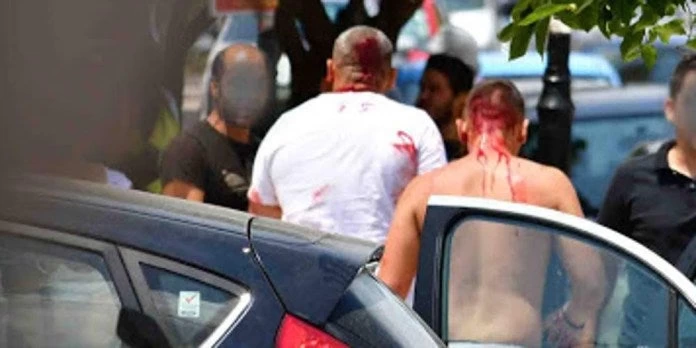 Συνέλαβαν 11 Ρομά για το αιματηρό επεισόδιο στο Ναύπλιο